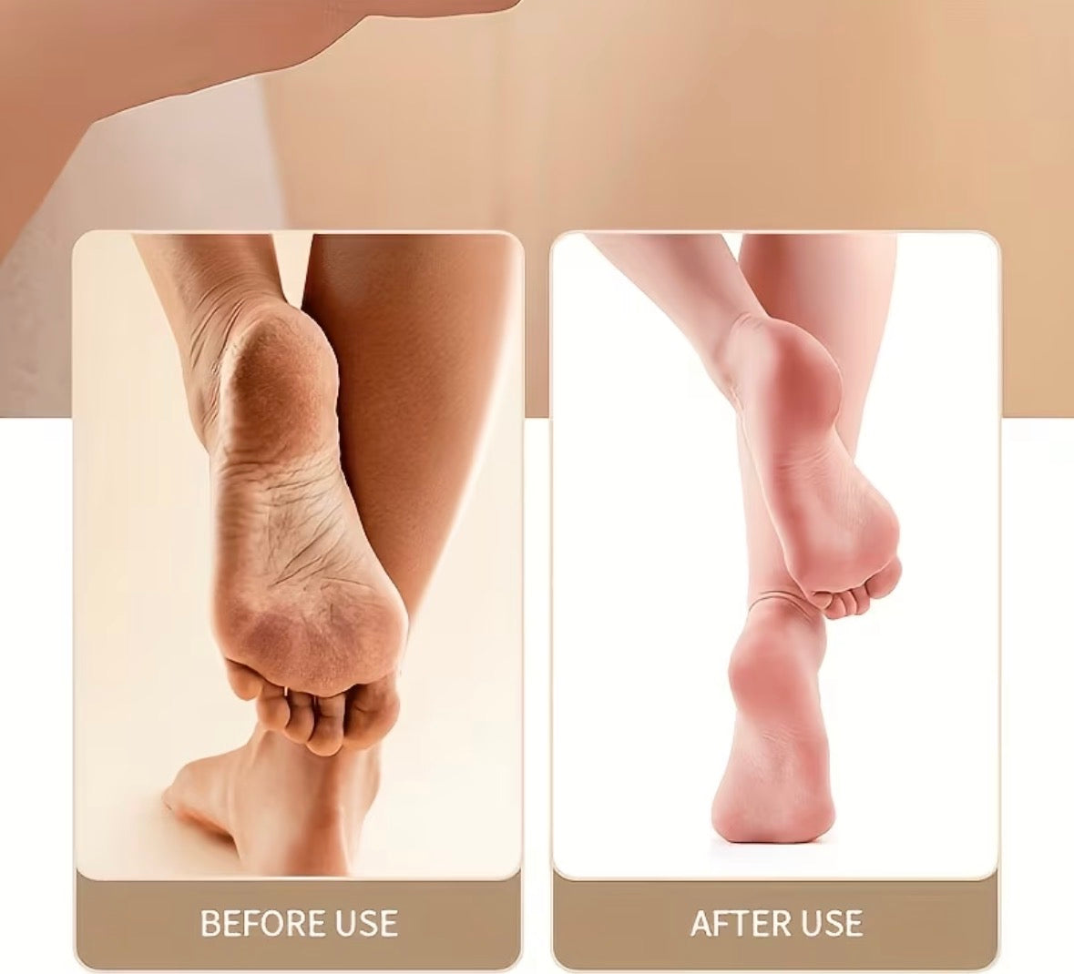 Electric Callus Remover – Rechargeable Foot Grinder & Pedicure Tool for Smooth Feet